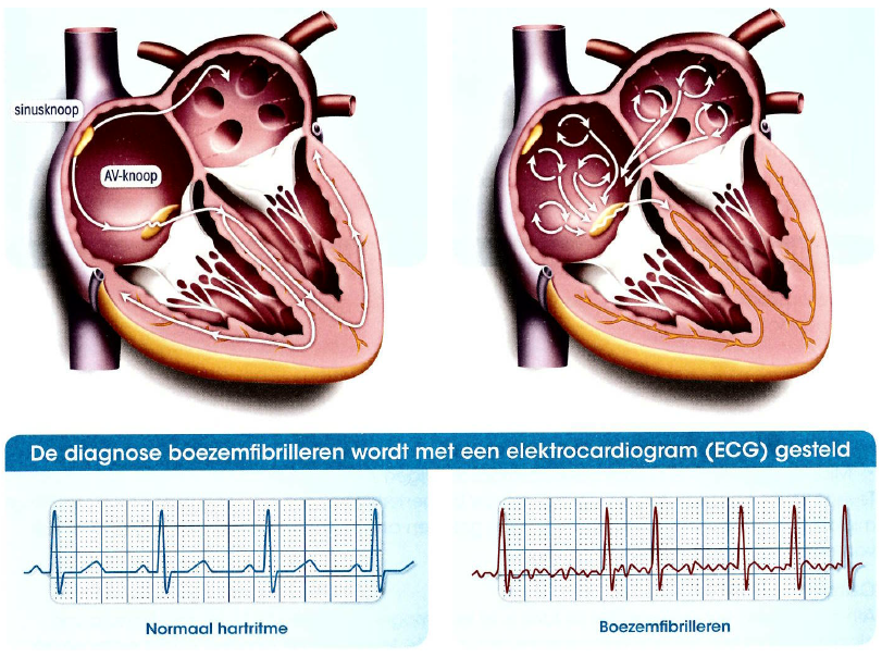 Medische illustratie hartritme