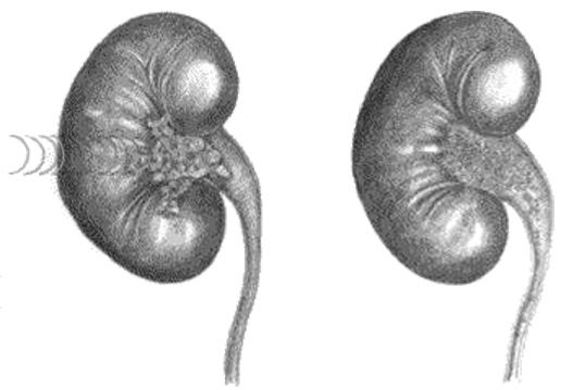 Illustratie nieren