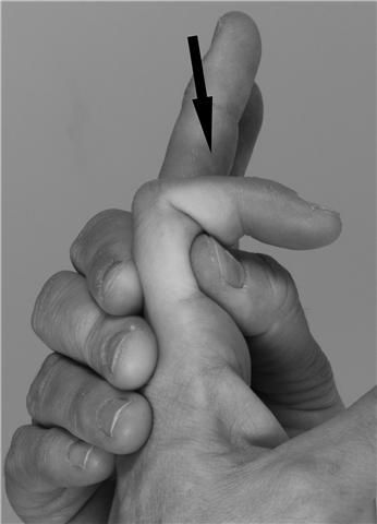 Foto buigoefening voor het middelste gewricht van de vingers