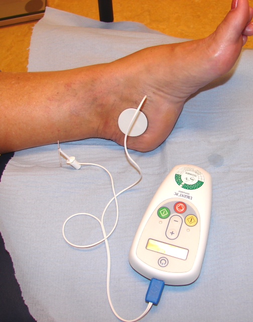 Afbeelding 1 Elektrode op voet