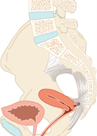 Afbeelding positie baarmoeder na sacrospinale fixatie