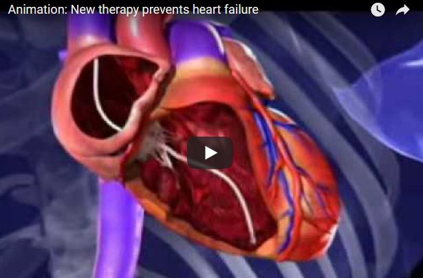 Screenshot video nieuwe therapie voorkomt hartfalen