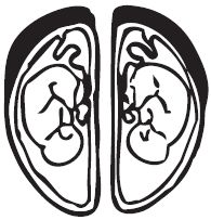 Afbeelding dubbele placenta's buitenvliezen en binnenvliezen