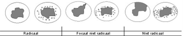 Illustratie snijvlakken