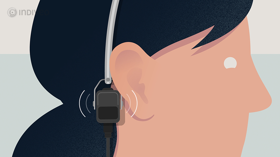 Illustratie uit divi audiometrie